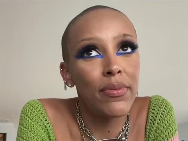 Doja Cat bald - August 2022