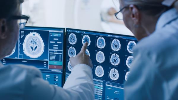 Doctors looking at brain scans